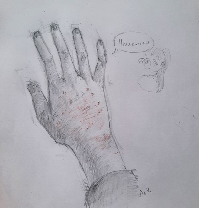 Жаркие беды.